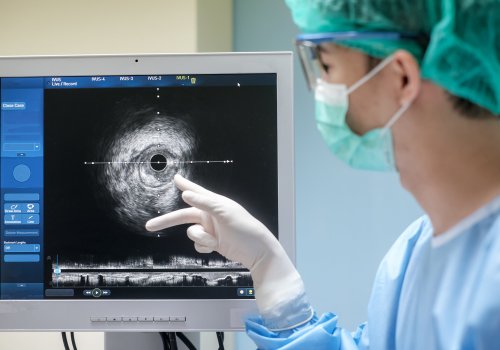 Doctor wears sterile uniform and uses Intravascular ultrasound imaging (IVUS) machine at cardiac catheterization laboratory room.